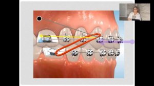 22. Биомеханика ортодонтического лечения (720p) (1)