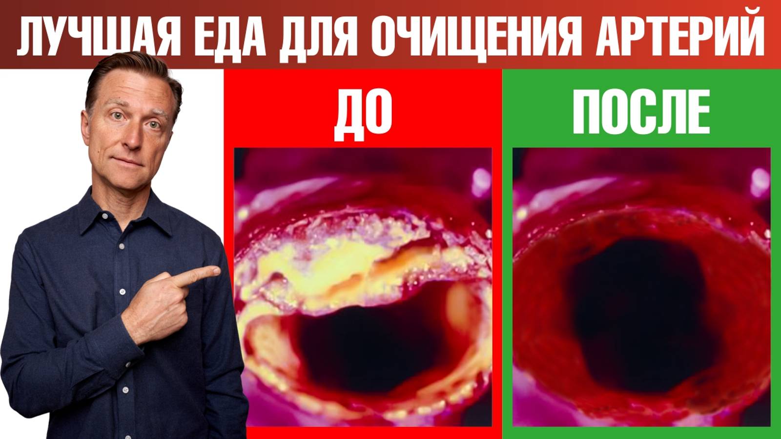 Лучшая еда для очищения сосудов от бляшек🤗