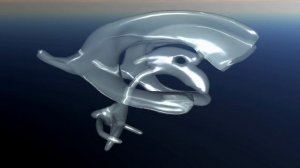 Желудочки мозга