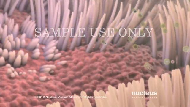 Smoking Causes Cancer, Heart Disease, Emphysema