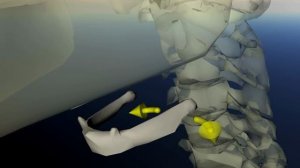 Подъязычная кость. Дисфункция