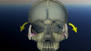 Скуловые кости. Дисфункция