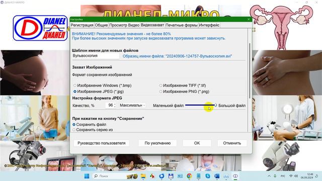 2024-09-06_125305-ПО Дианел®-Микро Кольпоскопия, Настройки- Видеозахват (видео, фото, СПРАВКИ TWAIN)