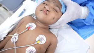 Scared and Shouting Crying Baby Goes under very hard Anesthesia