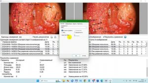 2024-09-10_181003-Сравнительный анализ, параметры сравнения, протокол на печать ПО Дианел®-Микро Кол