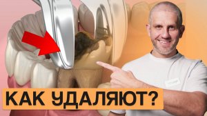 Насколько БОЛЬНО? Как проходит процедура УДАЛЕНИЯ ЗУБА?