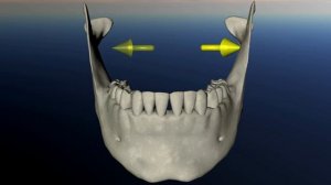 Нижняя челюсть. Дисфункция