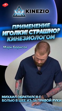 ИГОЛКИ! СТРАШНО? КОГДА КИНЕЗИОЛОГ ИСПОЛЬЗУЕТ ИГЛОРЕФЛЕКСОТЕРАПИЮ?