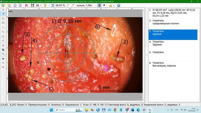 2024-09-10_174748- Окно Оценка и измерение кольпоскопических снимков в ПО ДИАНЕЛ®-МИКРО Кольпоскопия