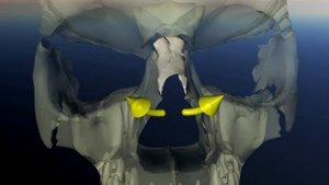 Носовые кости