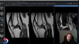Работа с цифровыми носителями. Программа Инобитек