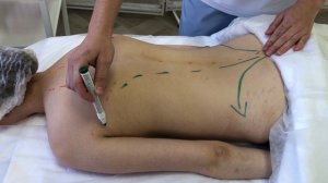 Массаж спины ч 3