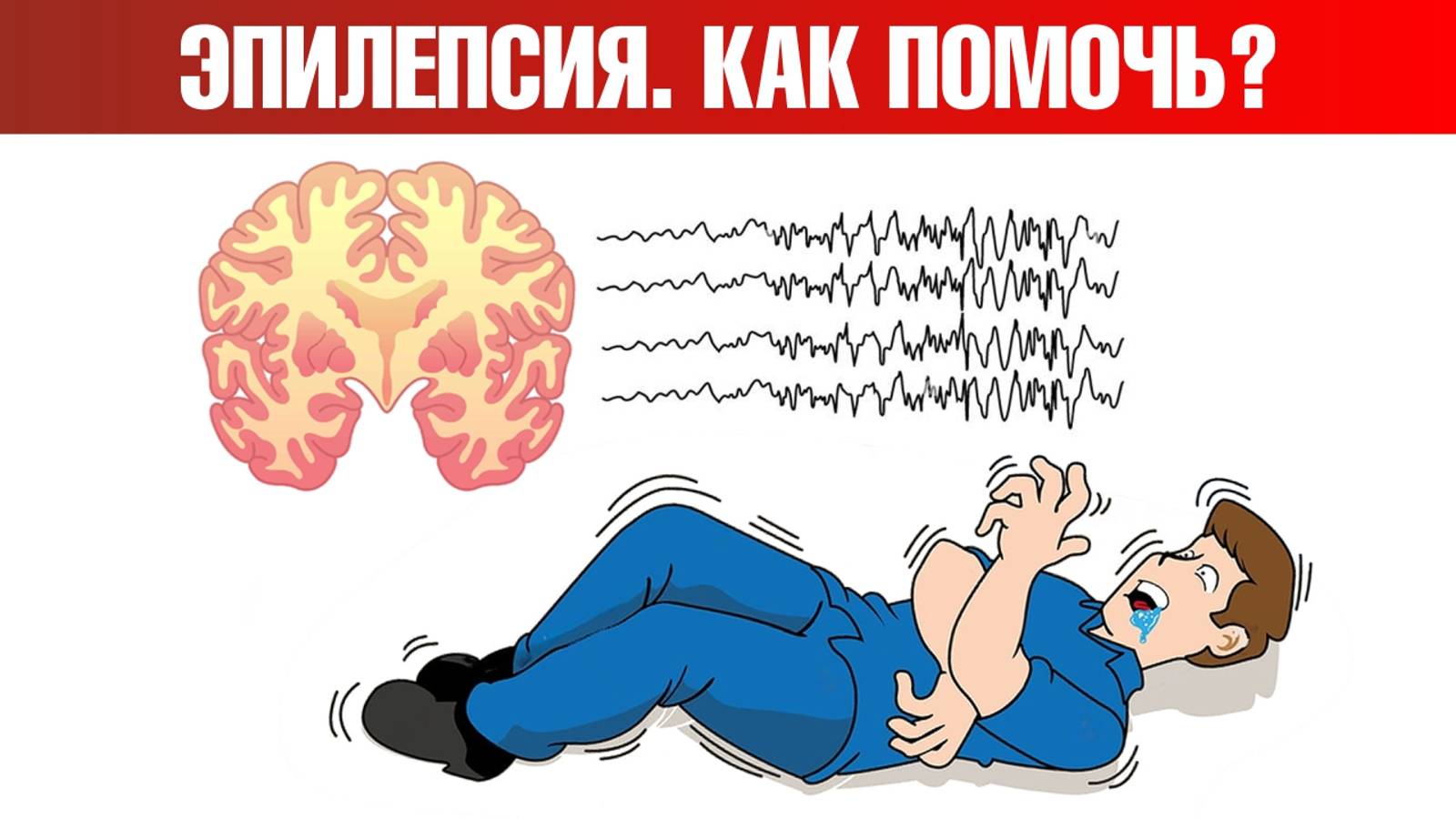 Эпилепсия (судороги, припадки) 👉 есть решение