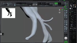 22. Fx Refinition Posterior Hair 1