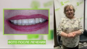 Отзыв о лечении и имплантации зубов при сахарном диабете.