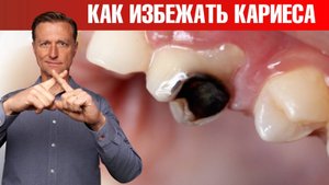 Как избежать кариеса и не допустить его появления?👀