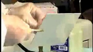 Центральное соотношение челюстей