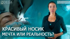 Как сделать идеальный нос? Ринопластика ДО и ПОСЛЕ. Клиника Dega