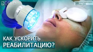 Как убрать отёки после ринопластики? Сколько длится реабилитация? Отзыв пациентки Клиники Dega