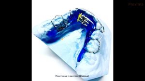 Ортодонтические пластинки с винтом