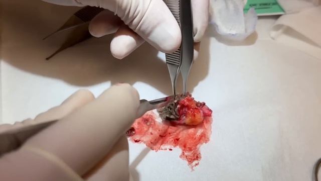 I see a lot of people with different skin tones.Understanding the intricacies is crucial.