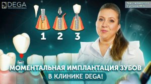 Одномоментная имплантация. Как проходит имплантация зубов. Клиника Dega