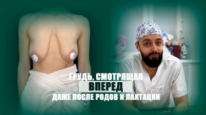 Подтяжка груди якорным способом для пациентки