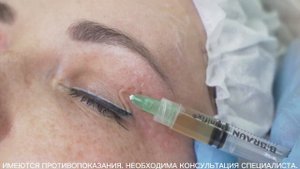МАСТЕР-КЛАСС «Комбинированная терапия COLLOST® micro и PRP в одном шприце»