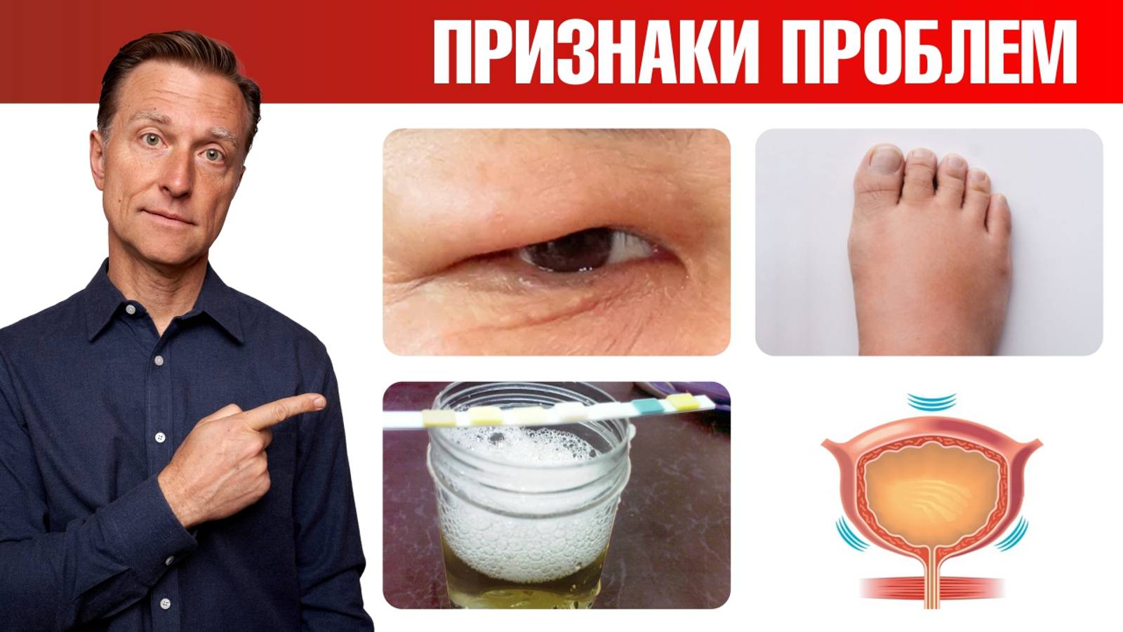 Заболевания почек: 10 признаков, что с почками беда😲