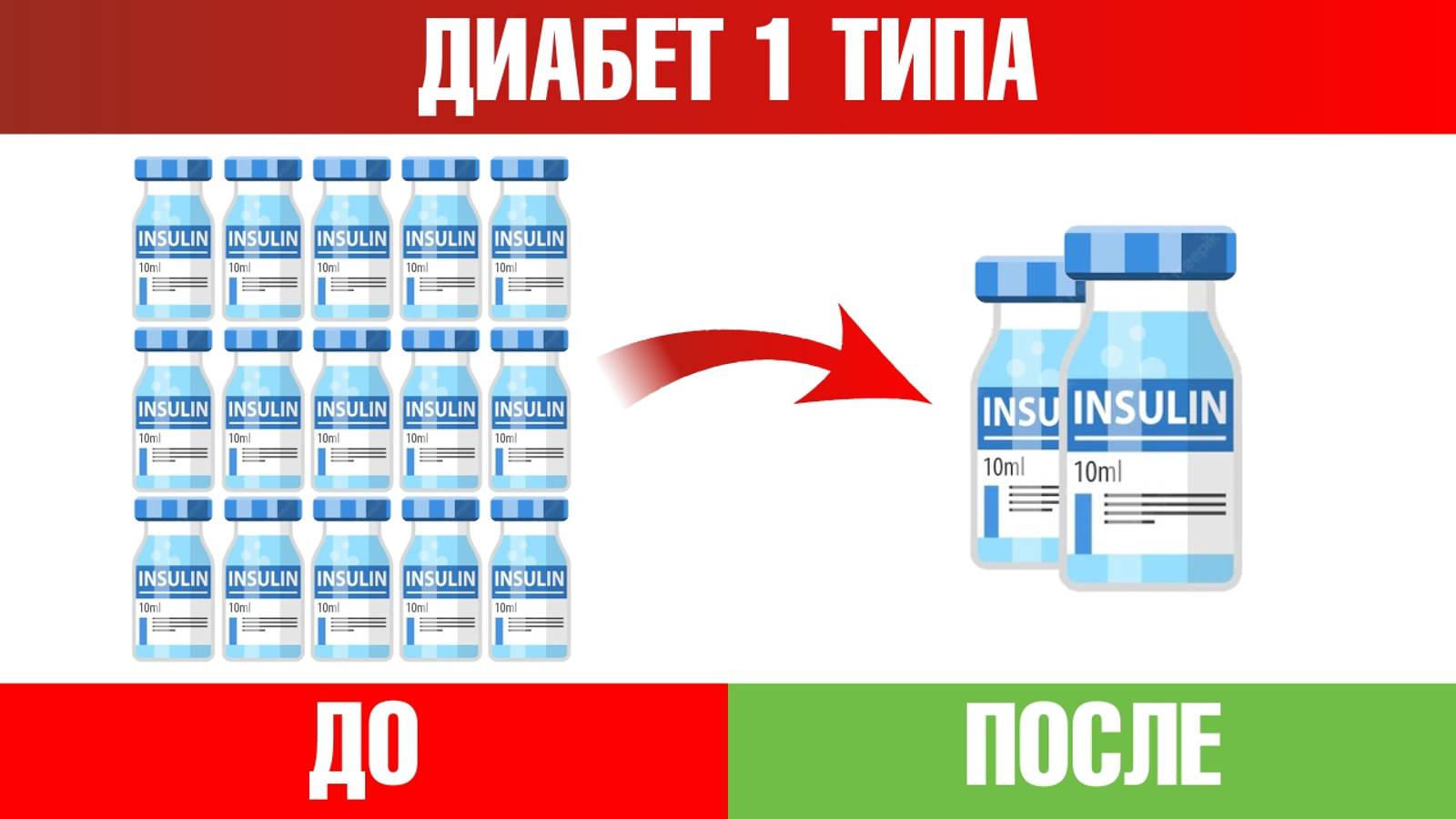 Диабет 1 типа👉Все, что нужно знать для снижения дозы инсулина