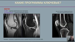 Особенности визуализации костей на МРТ