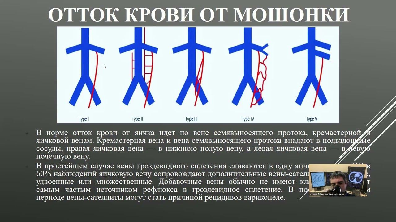 УЗД заболеваний органов мошонки. Часть 2.