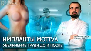 Увеличение груди имплантами Motiva. Липосакция бедер ДО И ПОСЛЕ