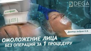 Быстрое омоложение лица за 1 процедуру. Увеличение губ. Пациентка - стилист Ирина Каховская.