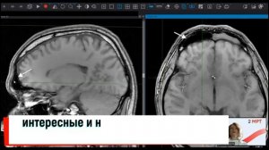 Что такое D2D NEURO?