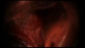 PAPA ROACH - Between Angels and Insects (Uncensored) (4K 60FPS)