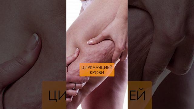 Как появляется ЦЕЛЛЮЛИТ? #целлюлит #здоровье #ароматерапия