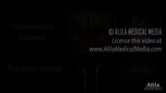 Hypertension - High Blood Pressure, Animation смотреть онлайн