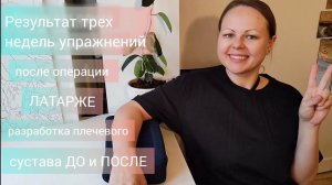 ДО и ПОСЛЕ трех недель упражнений после операции Латарже разработка плечевого сустава (вывих плеча)