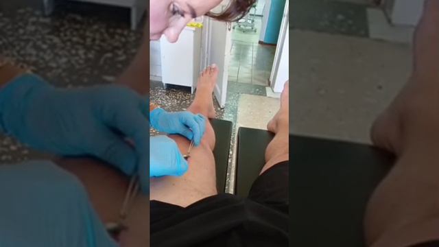 Якудза Терминатор. 25.07.2023г осколки сейчас уже все не вытаскивают , скоро солдаты терминаторами