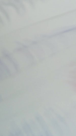 отвожу Реборна в больницу