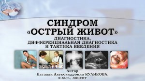 Видеолекция. Синдром острый живот - дифференциальная диагностика и тактика ведения.