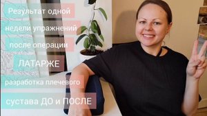 ДО и ПОСЛЕ недели упражнений после Латарже разработка плечевого сустава (операция при вывихе плеча)