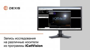 Запись исследования на различные носители из программы iCatVision
