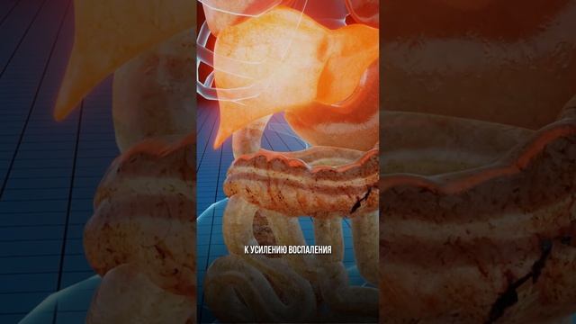 ОСТОРОЖНО! резкое ПОХУДЕНИЕ и ПЕЧЕНЬ – чем это ОПАСНО?