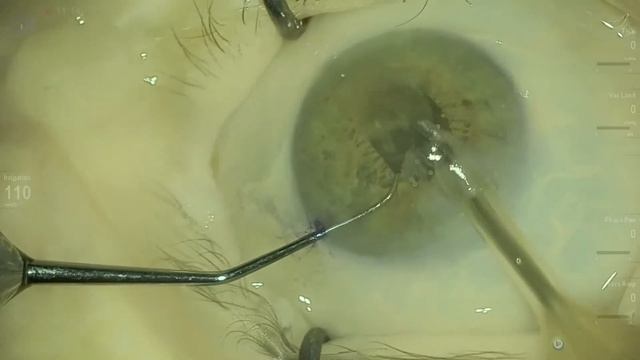 IFIS eye Anton Angelov Vista Live Stream смотреть онлайн