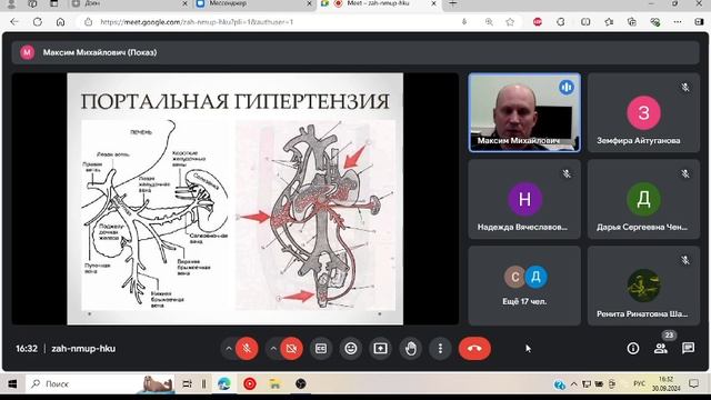 лекция детская хирургия|желудочно-кишечные кровотечения