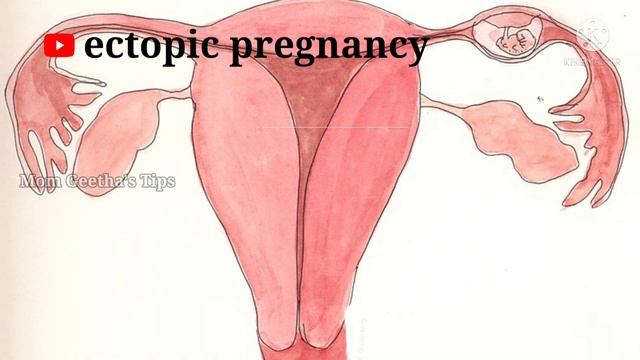 Reasons for false negative pregnancy test #pregnancy смотреть онлайн