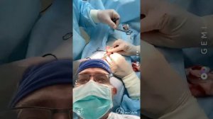 Обрезание крайней плоти (Циркумцизио) и пластика уздечки полового члена у мальчиков