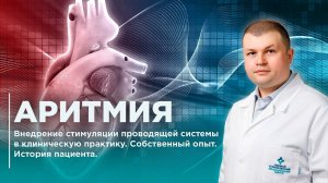 Аритмия. Стимуляция проводящей системы сердца. Истрия пациента ПКМЦ.